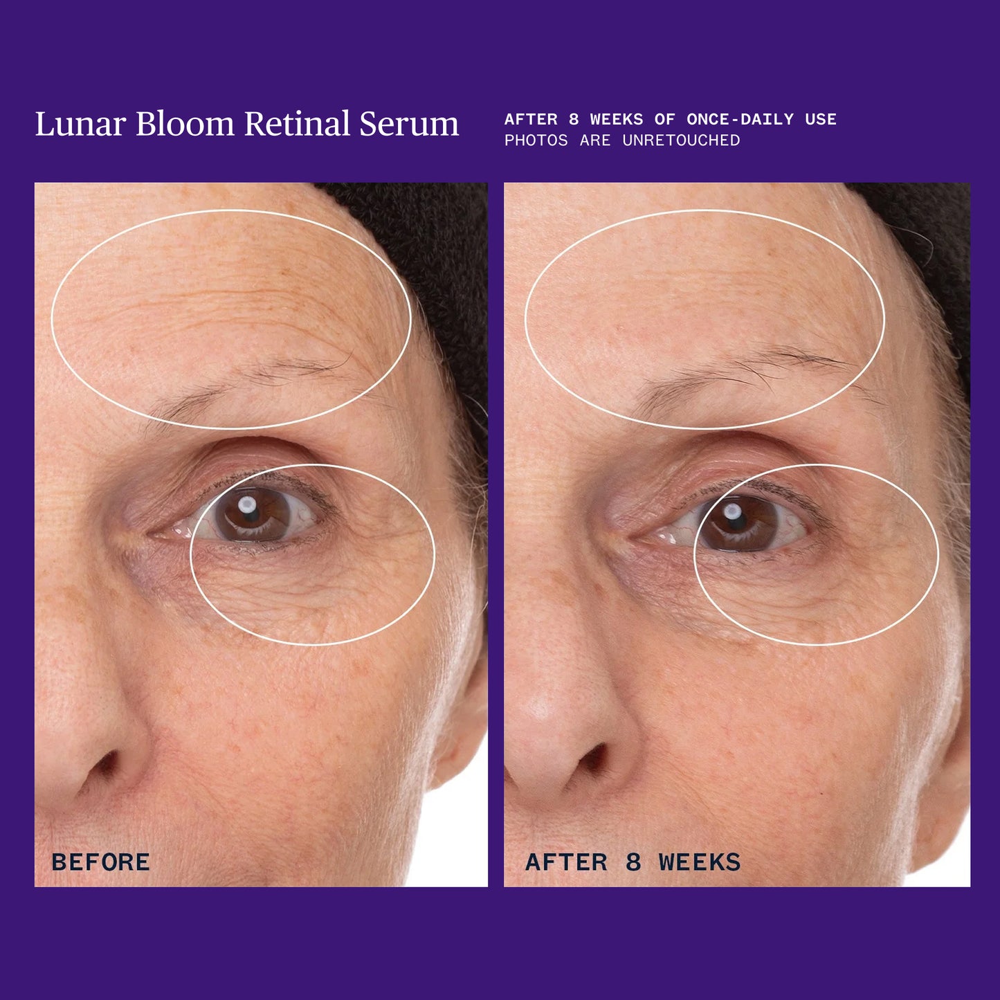 Lunar Bloom Retinal Serum